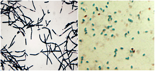 Bacillus anthracis bentuk vegetatif dan bentuk spora