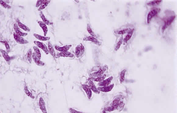 Toxoplasma ciszták