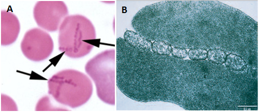 Haemobartonella canis dipermukaan eritrosit, (B) dengan mikroskop electron terlihat Haemobartonella canis dipermukaan eritrosit