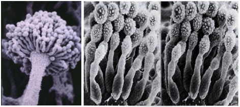 Aspergillus flavus (kiri) dan Aspergillus parasiticus (kanan) di bawah elektron mikroskop